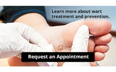 Plantar Warts Can Be Treated!