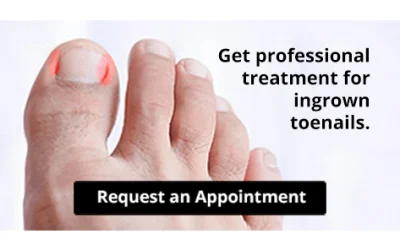 Are You Suffering From Ingrown Toenails?