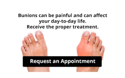 Are Bunions Affecting Your Everyday Life?