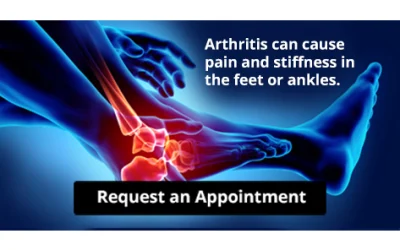 Arthritis Can Cause Pain in the Feet and Ankles