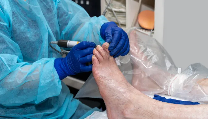 Lapiplasty Bunion in Allentown | PA Foot & Ankle Associates